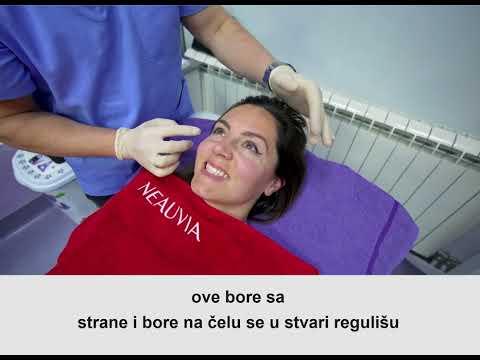 Botoks - dr Miodrag Đokić