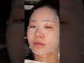 Korean facial & acupuncture for $50 in NYC! 🥺☁️ #shortvideo #skincare
