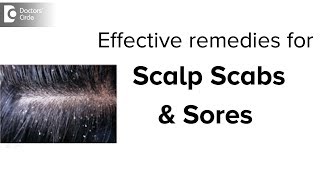 Scabs &amp; Sores on Scalp: Treatment, Causes &amp; Remedies - Dr. Aruna Prasad