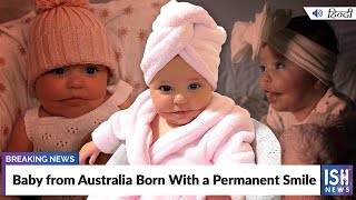 Baby from Australia Born With a Permanent Smile