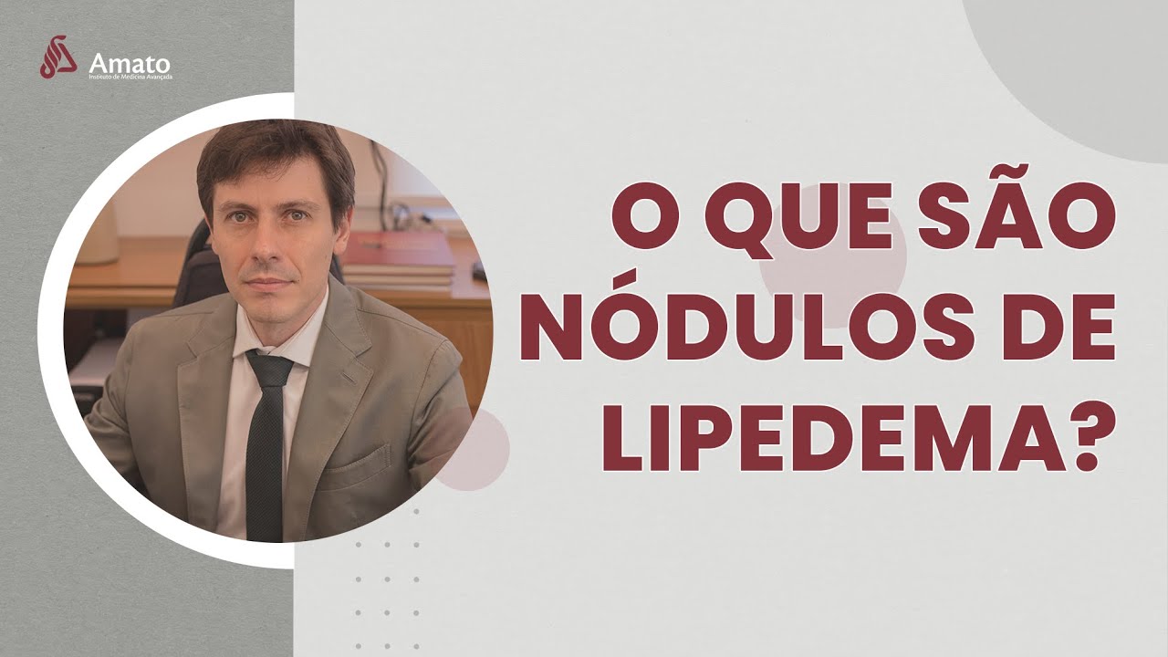 O que são os Nódulos de Lipedema?