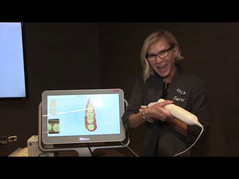 Scanning for a Single-Unit Crown with the iTero Element® 2 Intraoral Scanner