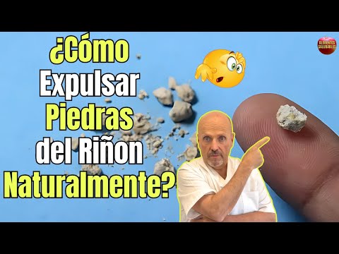 💝 ¿COMO EXPULSAR PIEDRAS DEL RIÑON NATURALMENTE? 💝