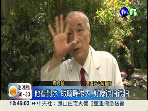 親睹狂犬病患痛苦 老醫生難忘!