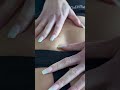 Skin Popping Low Back Chiropractic Adjustment