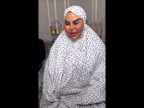 Is she rakhi sawant 👹 Rakhi sawant surgery fail🧟‍♀️ @tstreetcontroversy@Shorts_kingandqueen