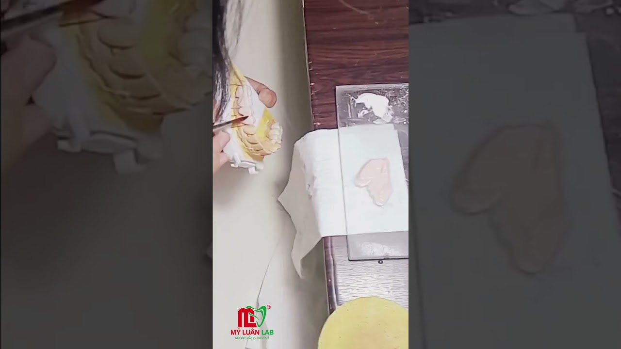 Đắp sứ tỉ mỉ từng lớp, tạo nên phục hình hài hòa, tự nhiên và chuẩn thẩm mỹ.