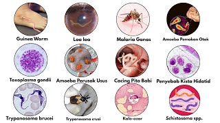 Download lagu The Most Horrifying Parasites That Usually Live in the Human Body! mp3 Download lagu The Most Horrifying Parasites That Usually Live in the Human Body! mp3