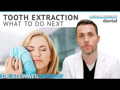 Recover Quickly After TOOTH EXTRACTION 🦷 6 Essential Steps To Follow | Dentist in Clarksville MD