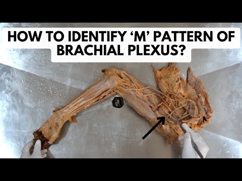 Brachial Plexus - Major Branches & Axillary Artery | Upper Limb Anatomy Dissection