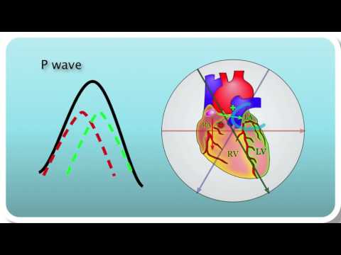 ECG Basics 4/10 - Wave Forms and Intervals