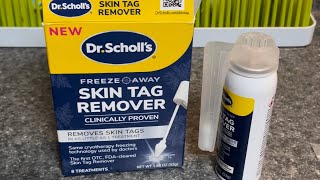 Dr. Scholl’s Skin Tag Remover | Application and After 7 day Results