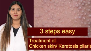 Keratosis pilaris treatment | chicken skin disease | bumps on upper arms | clogged pores treatment