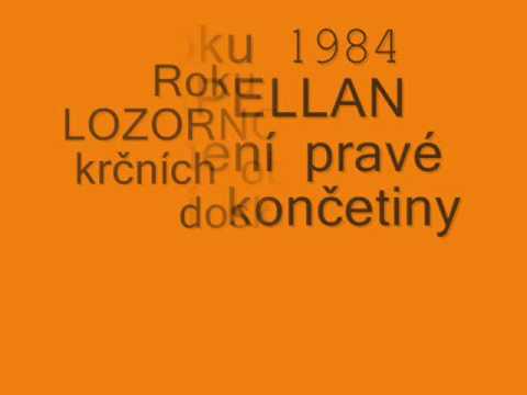 Velká Pardubická oběťi Taxisova příkopu