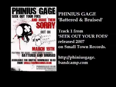 Phinius Gage - Battered & Bruised