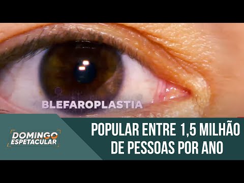 Blefaroplastia: conheça os riscos da cirurgia plástica mais realizada no mundo