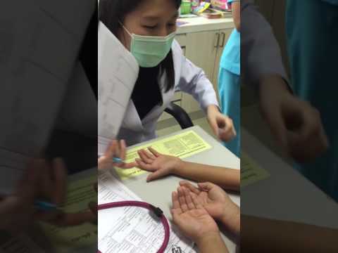 โรคสะเก็ดเงินในเด็ก 6 เดือน ผิวหนังอักเสบ seborrheic ของหนังศีรษะวิธีที่จะรักษามัน
