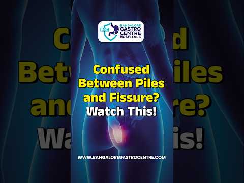 Confused Between Piles & Fissure? Know the Difference in 60 Seconds!