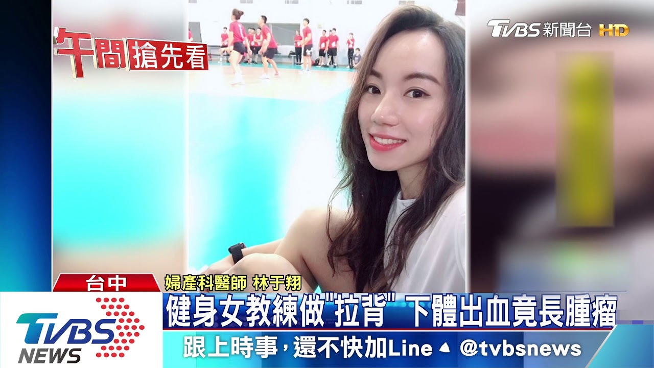 健身女教練做「拉背」 下體出血竟長腫瘤