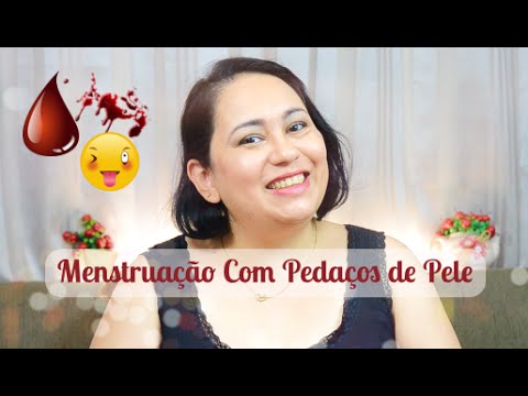 Já aconteceu de sair pedacinhos de sangue durante sua menstruação