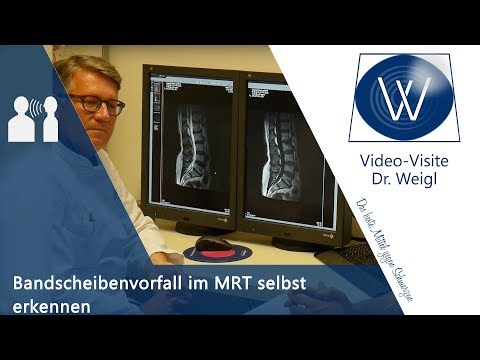 Taganrog von Spine Krankenhaus Lauf Schmerzen am Sprunggelenk
