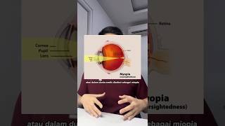 Download lagu Apakah mata minus bisa sembuh ? 👀👁️ #dokter #edukasikesehatan mp3