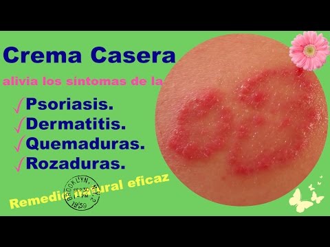 Gli antieczemi di bepanten per comprare Vasche da bagno a neurodermatitis a bambini