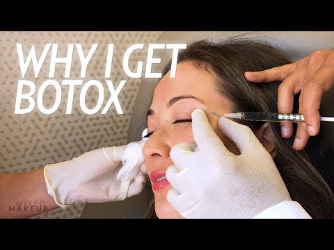 Why I Get Botox Injections for Wrinkles and More! | Beauty with Susan Yara