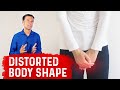 Hysterectomy And Your Body Shape
