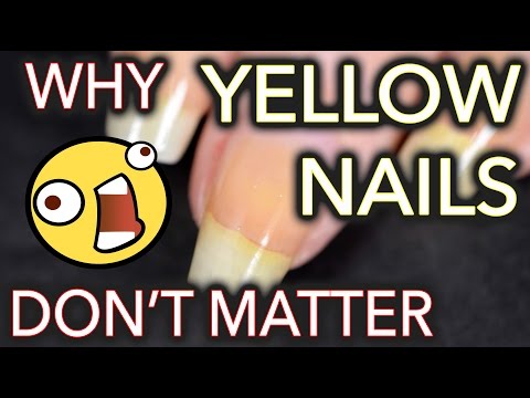 Why yellow nails DON'T MATTER / Don't whiten your nails