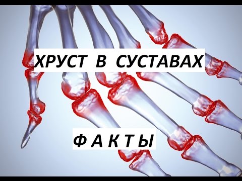 Суставы хрустят Причины и Лечение