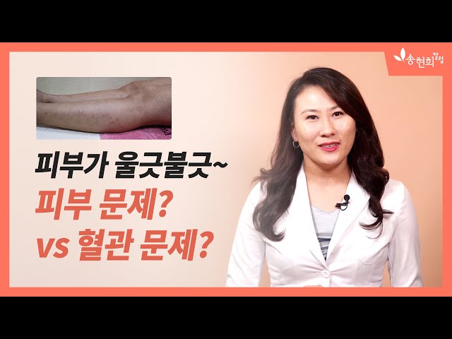 Προφορά βίντεο 문제 στο Κορέας