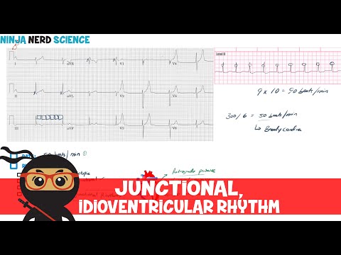 Rate and Rhythm | Junctional and Idioventricular Rhythm