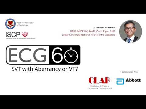 SVT WITH ABERRANCY OR VT? EASY WAY TO DIFFERENTIATE IT!