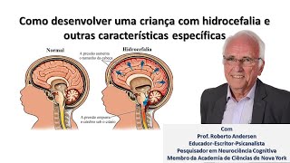 Como desenvolver uma criança com hidrocefalia e outras dificuldades específicas