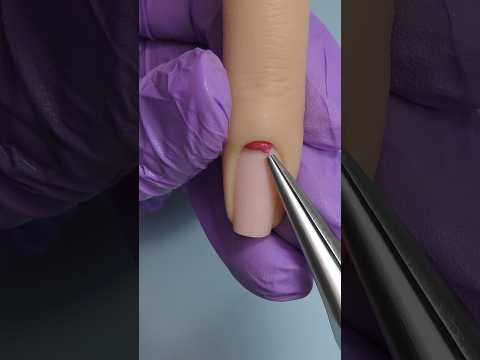 Something is trapped under the cuticle 😱🫣