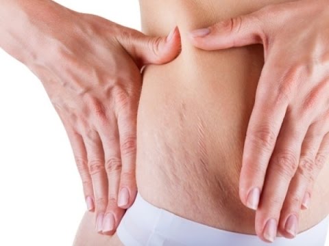 Articolazioni crema disaar Forte unguento analgesico per giunti