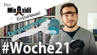 Das Minoxidil Experiment #Woche21 Was ist ein Dermaroller?