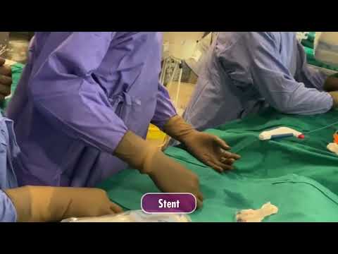 IVUS Guided Iliac Vein Stenting Procedure