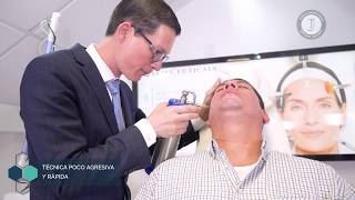 Crioterapia, retiro de verrugas con la aplicación de nitrógeno