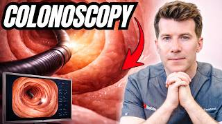 Doctor explains Colonoscopy | Prep, during and after - what you need to know