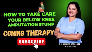 How to take care of your below knee amputation stump - Coning Therapy #skincare #plasticsurgery