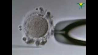 ICSI - l'iniezione di un singolo spermatozoo all'interno del citoplasma dell'ovocita