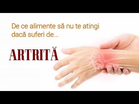 Cum se tratează artrita artroza mâinilor