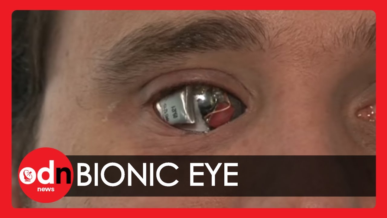 Advanced Bionic Eyes and Implants: New Help For The Blind
