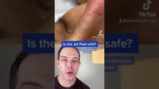Crazy way to remove blackheads Jet Peel Demo | 208SkinDoc