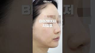 [BB 클리닉] 위치는 강남역 6번 출구로 오세요~