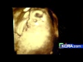 Internet Ultrasound