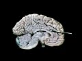 The Triune Brain (1984)