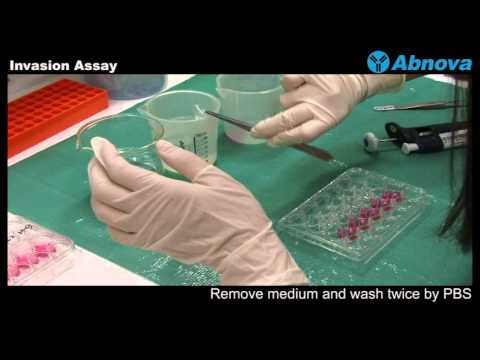 Invasion Assay